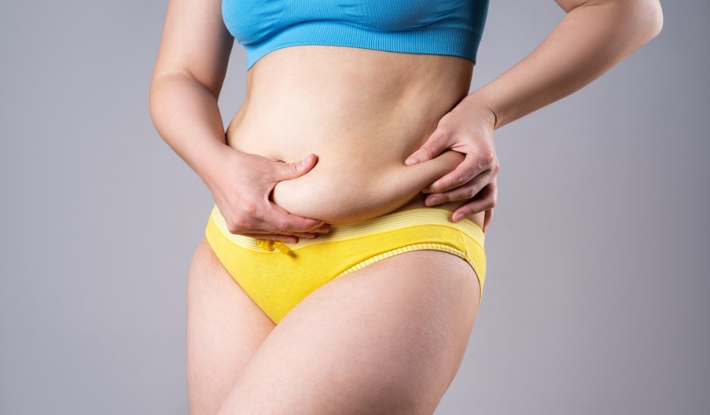 Tummy Tuck in Turkey (Abdominoplasty)