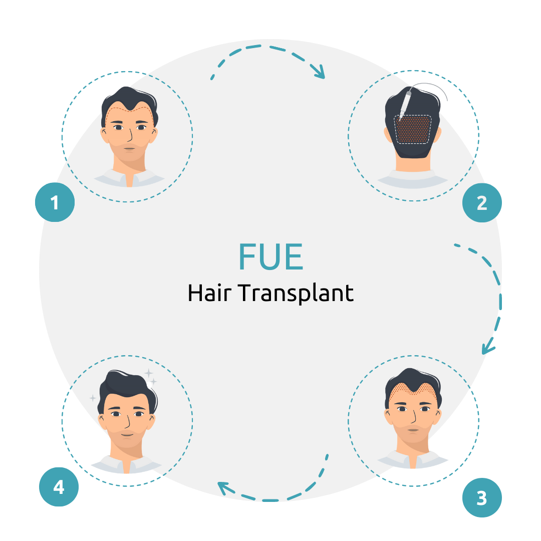 FUE (Follicular Unit Extraction) Greffe de cheveux Turquie